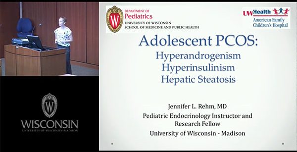 Adolescent PCOS - More than Meets the Eye Hyperandrogenism, Hyperinsulinemia, and Hepatic Steatosis