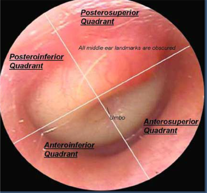 AOM diagram