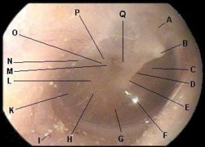 Tympanic Membrane Anatomy - Department of Pediatrics