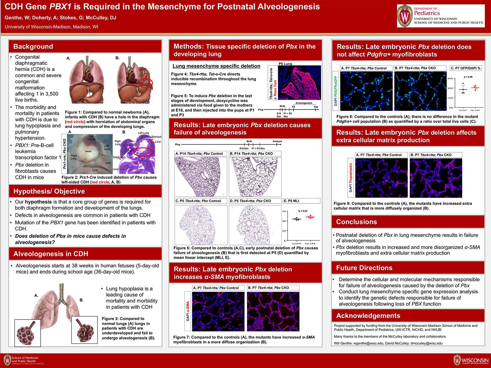 10. CDH Gene PBX1 is Required in the Mesenchyme for diaphragm formation and Postnatal Alveologenesis poster image