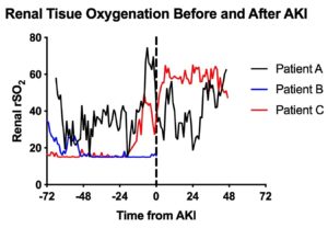 Renal Tissue Oxygenation Before and After AKI graph