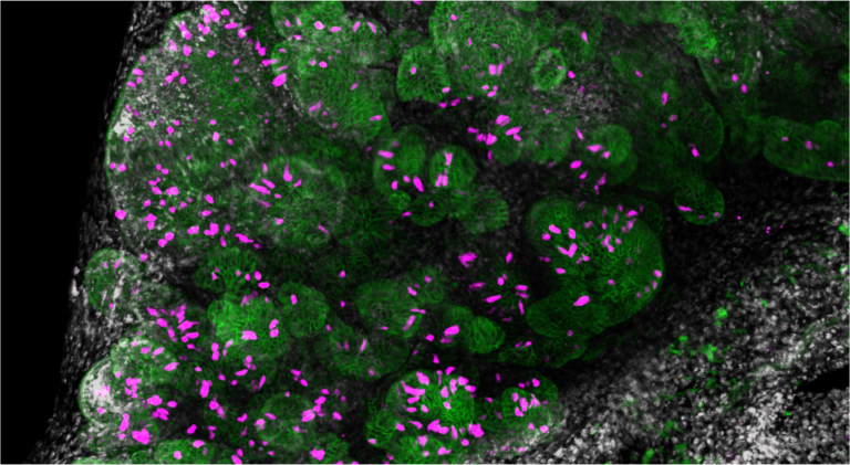 Fluorescent imaging of mouse cystic duct. Tuft cells (magenta) are identified by expression of IL-25 reporter. O'Leary et al Sci Immunol 2022