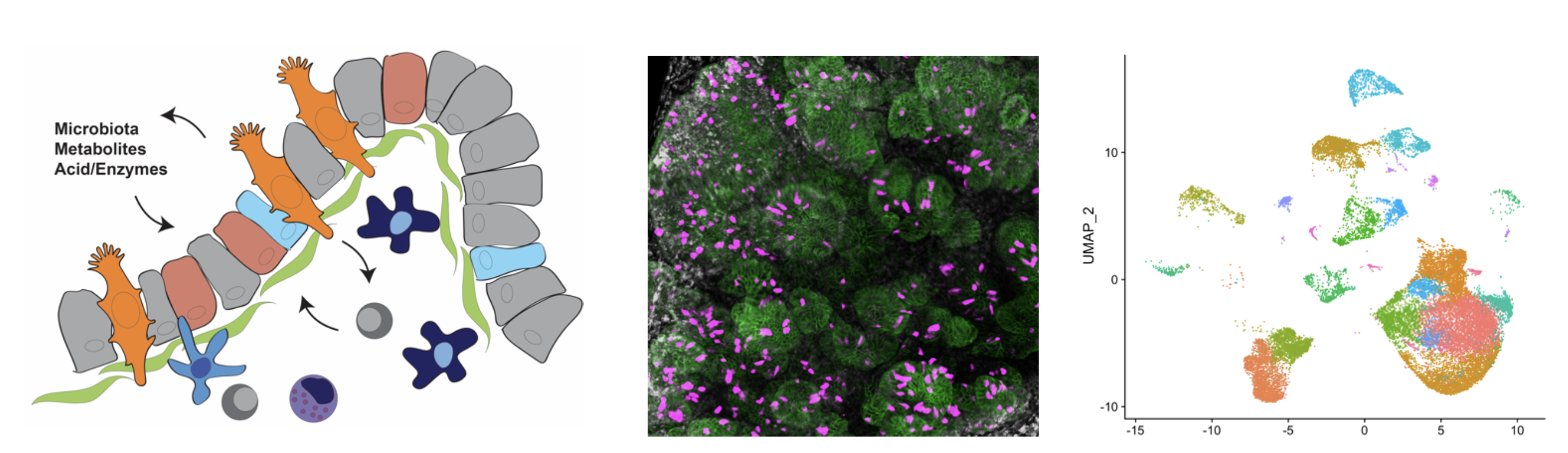 a set of one microscope image and two scientific diagrams